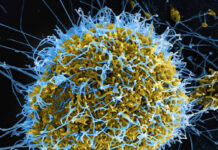 Africa Is Burying Its Dead From Ebola. The World Has Barely Noticed.