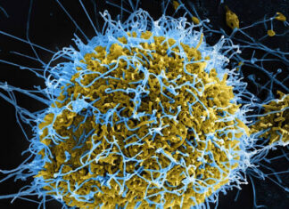 Africa Is Burying Its Dead From Ebola. The World Has Barely Noticed.