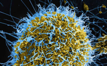 Africa Is Burying Its Dead From Ebola. The World Has Barely Noticed.
