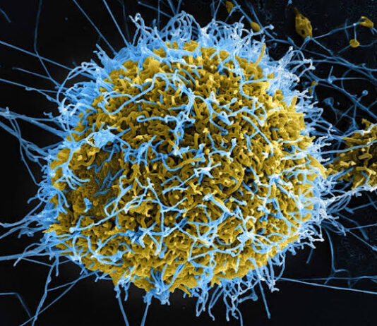 Africa Is Burying Its Dead From Ebola. The World Has Barely Noticed.